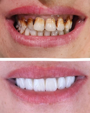 Slider image (4) Gordion Dental Clinic